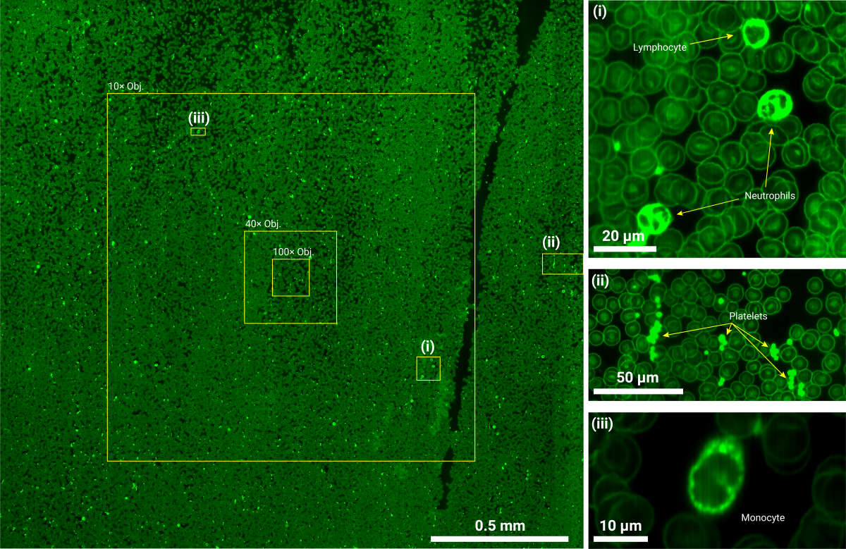 Blood smear using SPI