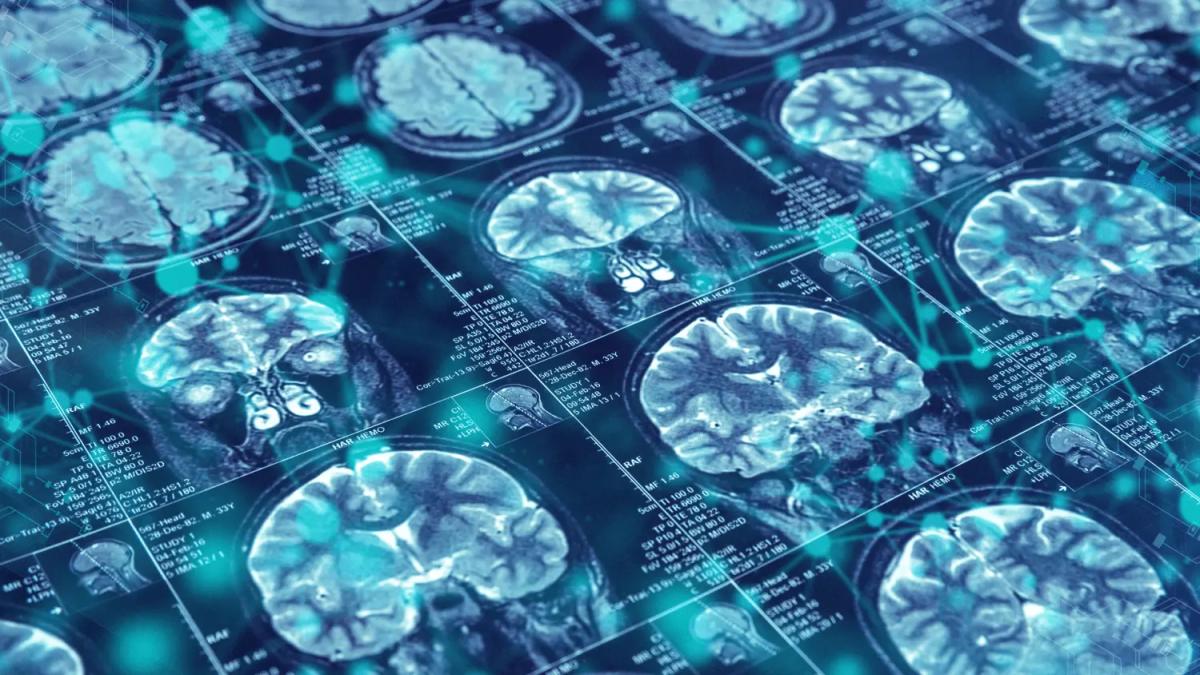 brain scan imaging