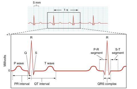 ECG (EKG) labeled diagram