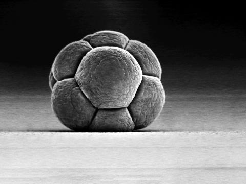 Nanowire Sphere Nanowire Sphere