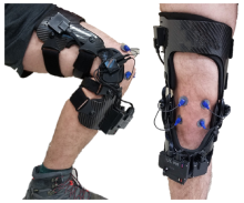 Instrumented Knee Brace